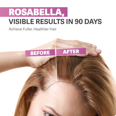 Rosabella Biotin Gummies for Hair, Skin & Nails
