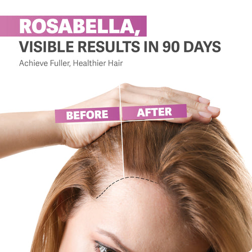 Rosabella Biotin Gummies for Hair, Skin & Nails